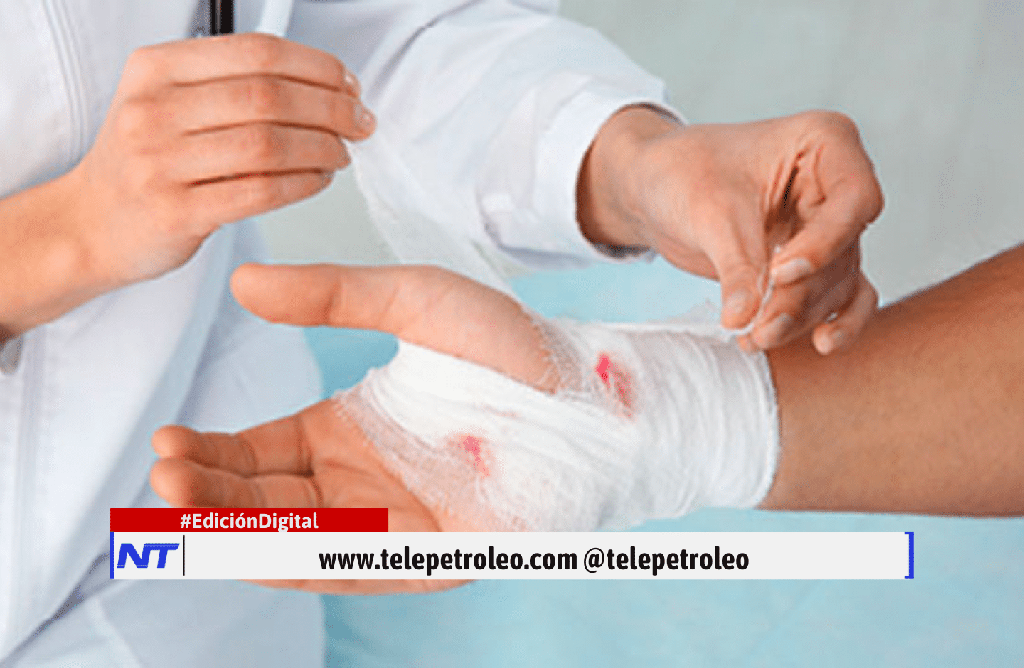 lesionados por pólvora en Barrancabermeja, heridos por pólvora en Barrancabermeja, balance de pólvora en Barrancabermeja, accidentes por pólvora en Barrancabermeja, quemaduras por pólvora en Barrancabermeja, afectados por pólvora en Barrancabermeja, uso de pólvora en Barrancabermeja, vigilancia epidemiológica pólvora Barrancabermeja, Secretaría de Salud Barrancabermeja pólvora, festividades con pólvora en Barrancabermeja